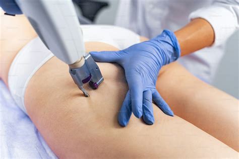 bg3 non-invasive procedure