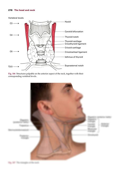 SOLUTION: Head and neck paranasal sinuses glands - Studypool