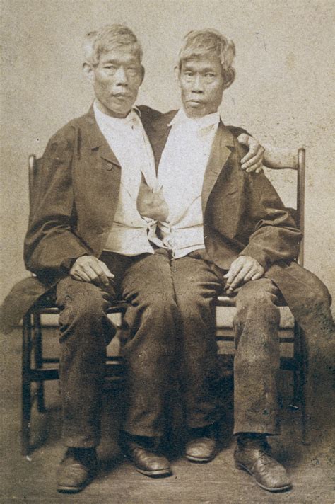 Chang and Eng Bunker, the 'definitive' Siamese twins, 1865. [2048×1363