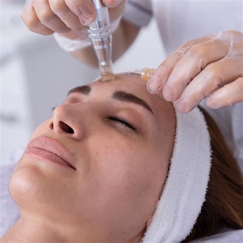 Microneedling Depth Guide Through Areas & Concerns