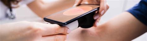 Skin Cancer Program: Diagnosis & Treatment | Skin Cancer Program
