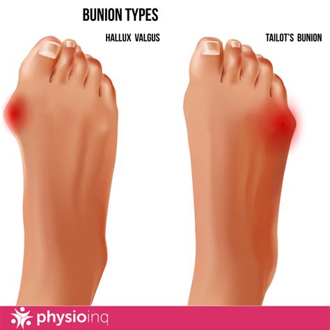 how to fix a blister fast