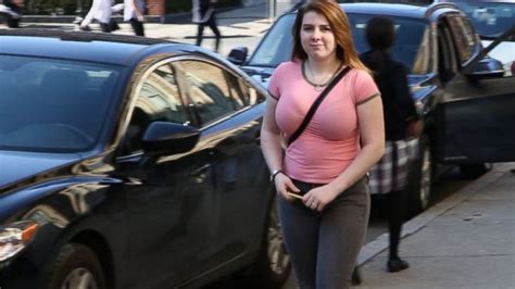 turning   turning  breast reduction surgery abc news