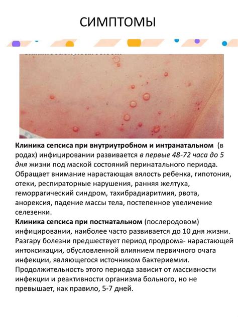 Сепсис новорождённого. Неонатальный сепсис - презентация онлайн