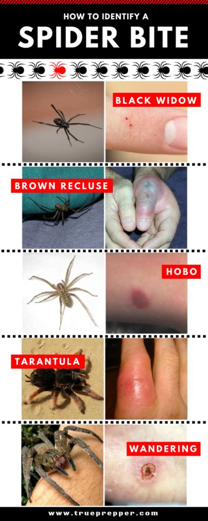 How to Identify a Spider Bite and Treat It | TruePrepper