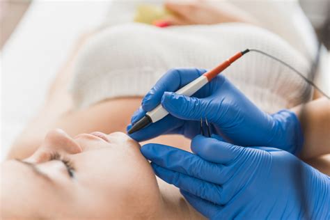 Electrolysis - Little Beauty Academy