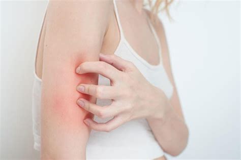 Perth Holistic & Natural Skin Treatment for Chronic Skin Conditions