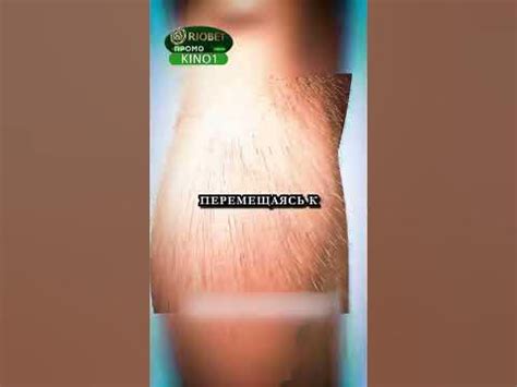 Что такое гвинейский червь 😨#short #shorts #фильмы #сериалы #шортс ...