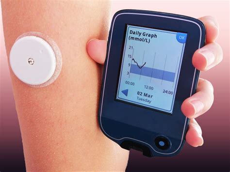 Continuous glucose monitors ease care for parents of young children