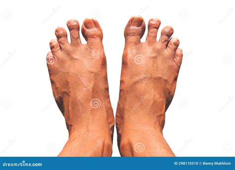 foot isolated  white background stock photo image  health