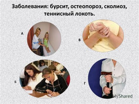 Презентация на тему: "Заболевания: бурсит, остеопороз, сколиоз ...