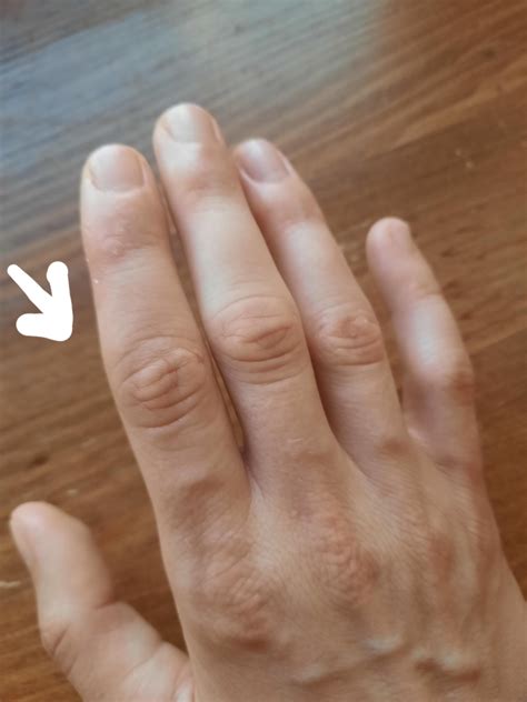 Does this look like psa? I have sharp pain that comes and goes in my