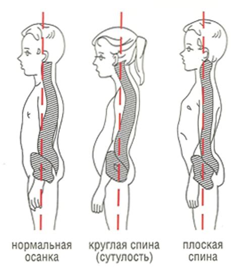 Правильная осанка у дошкольников