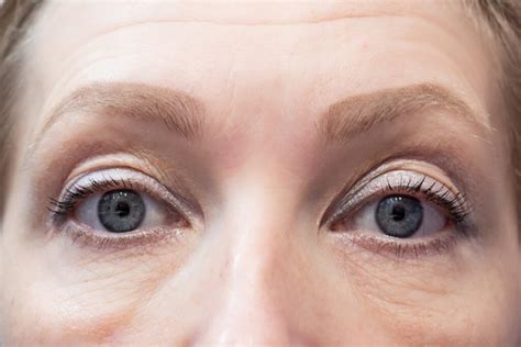 Asymmetrical Face | Dr Mark Doyle