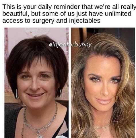 Kyle Richards before and after : r/VindictaRateCelebs