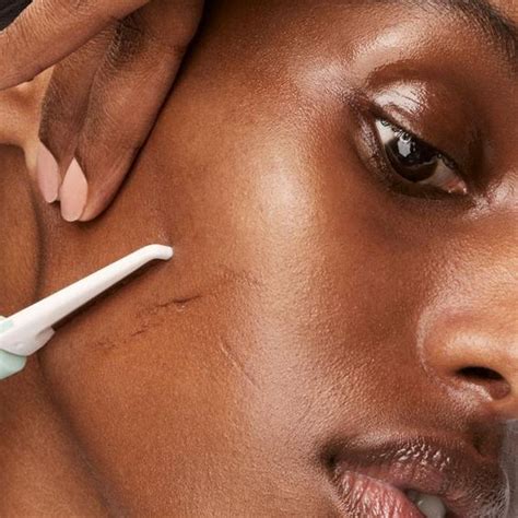 Dermaplaning O Que É - Dermaplaning: o que é, benefícios | BOA FORMA