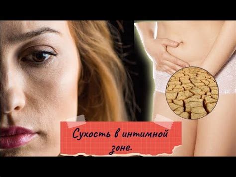 Сухость в интимной зоне. Аптечные средства от сухости в интимной зоне ...
