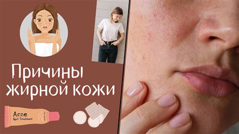 Причины жирной кожи на лице. Почему жирнеет кожа лица? Как избавиться ...