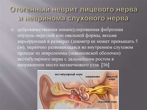 Отогенный неврит лицевого нерва - презентация онлайн