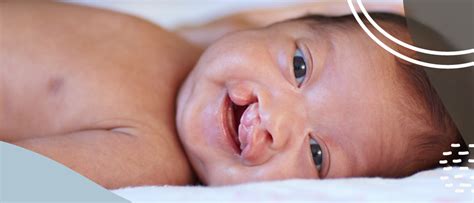 Exploring the Most Rare and Terrifying Birth Defects: Understanding Their Impact on Families - Hunter Games Magazine
