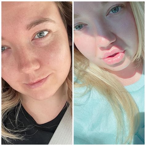 Got my 3rd syringe today 🙊 quite the before & after! 💕 : r/bimbofication