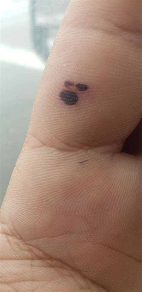 This blood blister on my hand looks like a little face yelling in anger ...