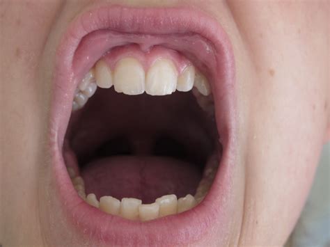 Carnivores Teeth