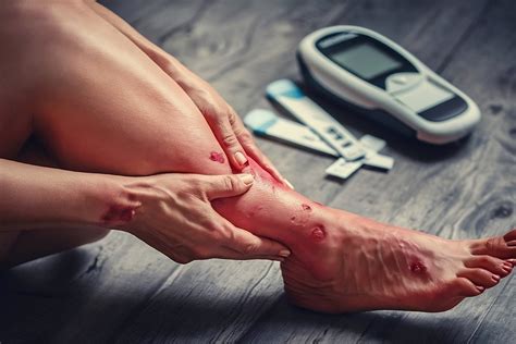 Can Diabetes Cause Foot Pain? | Foot + Ankle Specialty Centers
