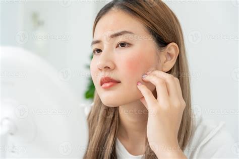 Young woman are worried about faces Dermatology and allergic to