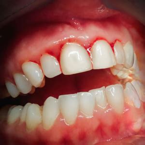 red bleeding gums ability toolbox guidebook