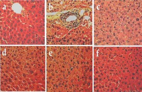 Histopathology of the Liver for Alcohol Induced Animal. a Normal group ...