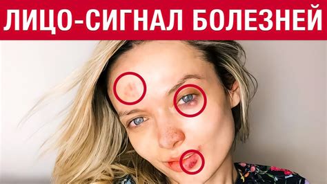 Ваше лицо КРИЧИТ вам о БОЛЕЗНЯХ! 5 болезней, которые ВИДНО на лице ...