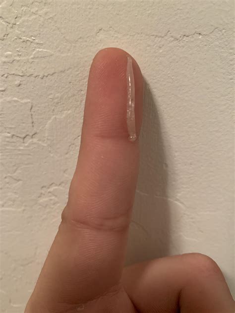 I've been coughing up these fluid filled casings that look like worms