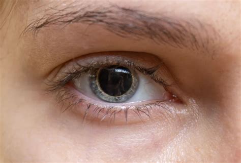 Pupilas dilatadas o midriasis: causas, cómo quitar y cuándo preocuparse