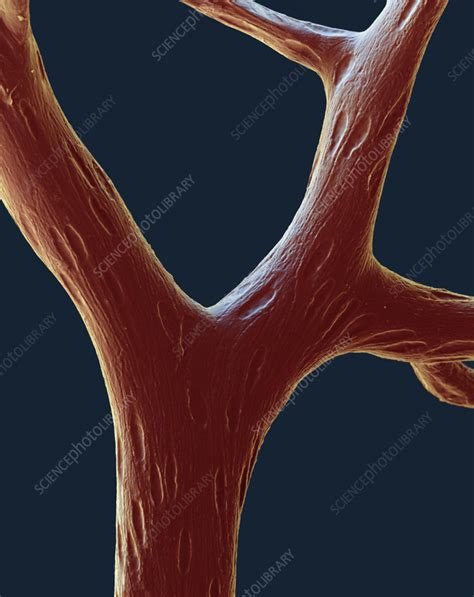 Capillary blood vessels, SEM - Stock Image - C058/0869 - Science Photo ...