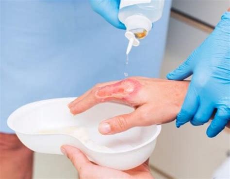 Wound Cleaning - Importance and Techniques | Flen Health