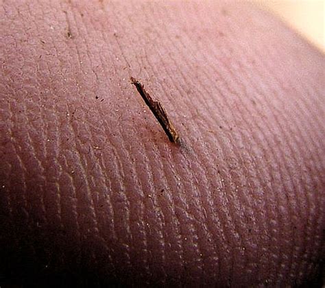 Splinters!