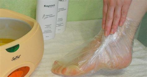 Косточка на ступне - Со Вкусом