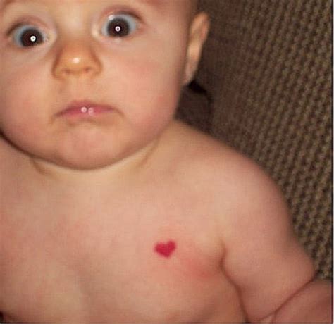 18 Genetic Anomalies That are Rare and Unique | eBaum's World