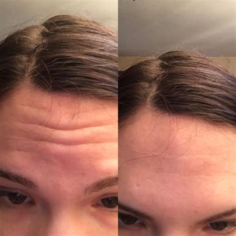 Does Tanning Give You Wrinkles at Tayla Stang blog
