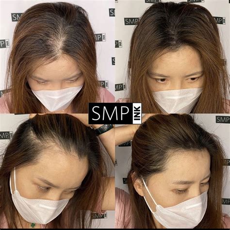 how to improve hair density