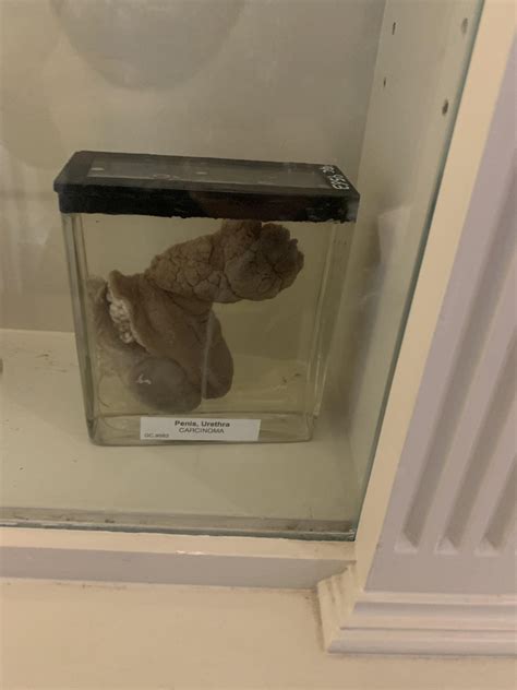 Surgeons Hall, Edinburgh : r/mildlyinteresting