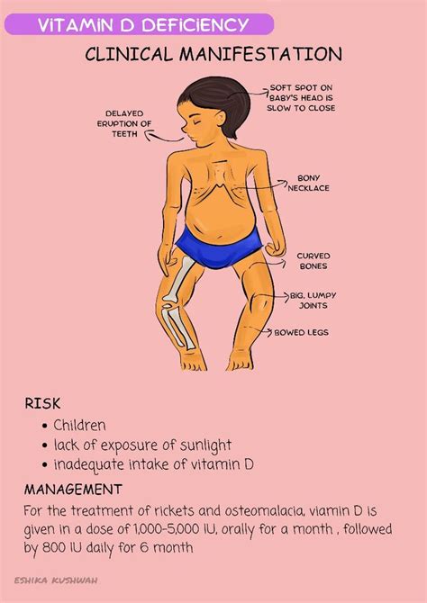 vitamin  deficiency diseases  children