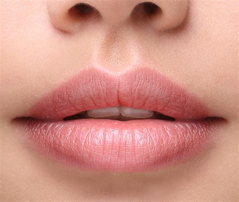 Lip Flip mit Botox - Die fünf häufigsten Fragen | Medical Beauty Concepts