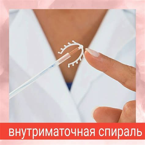 Внутриматочная спираль: плюсы, минусы и принцип действия | Здоровье ...