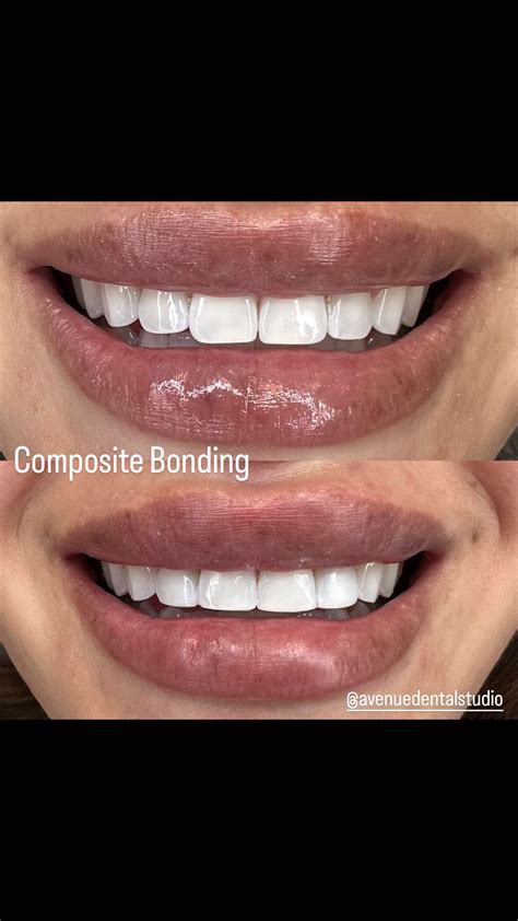 Dr Kelly Lamoreaux, Cosmetic Dentist, CEO of Abs After Babies | I love