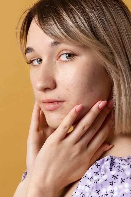 Как выглядит моллюск на лице