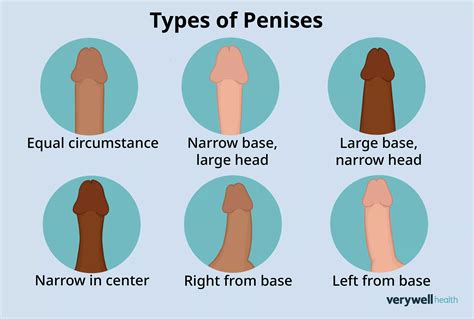 26 Types of Penises and Various Conditions