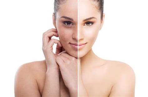 Enhance your Looks by Achieving Clear and Bright Skin by Afzal Choudhry