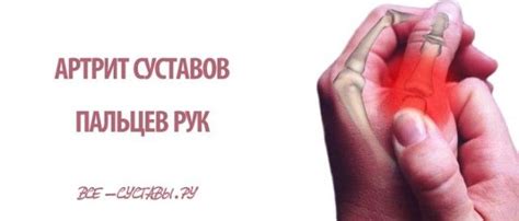 артрит суставов пальцев рук | Артрит, Здоровье, Мышечная система
